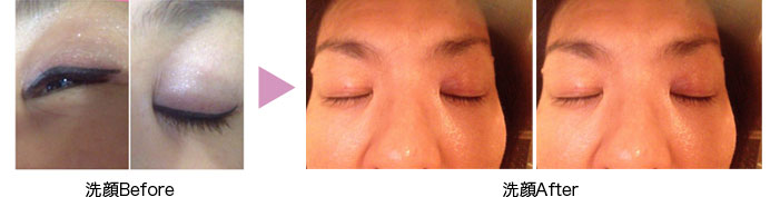洗顔前、洗顔後写真